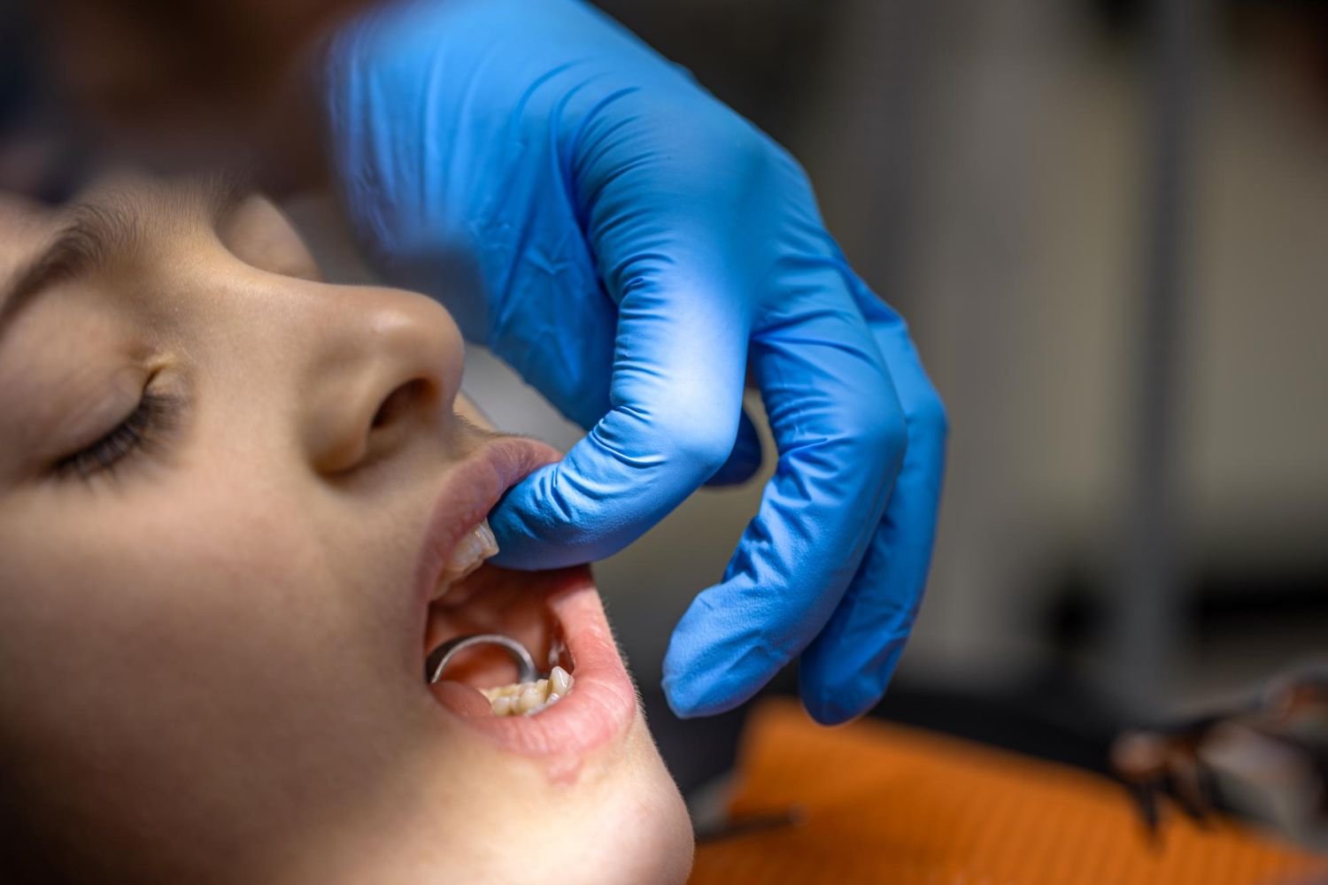 OSMF / Trismus Surgery (Mouth Opening Surgery)