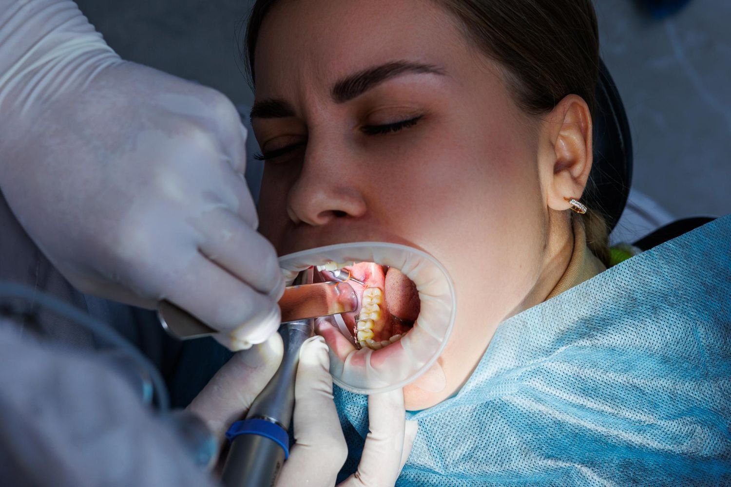 Maxillofacial & Oral Oncology